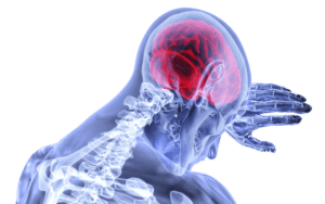 O que é atrofia cerebral e qual o melhor tratamento