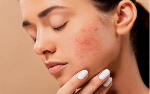 Como são as infecções de pele e como trata-las
