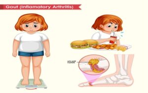 10 Alimentos para vencer inflamacao da artrite reumatoide