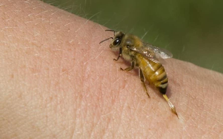 Como remover com seguranca um ferrao de abelha