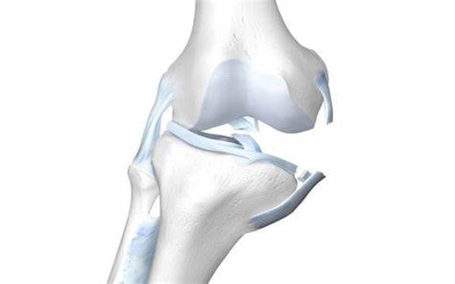 Como tratar uma entorse no ligamento colateral medial