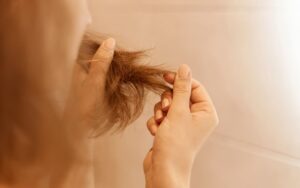 Controle da natalidade causa perda de cabelo