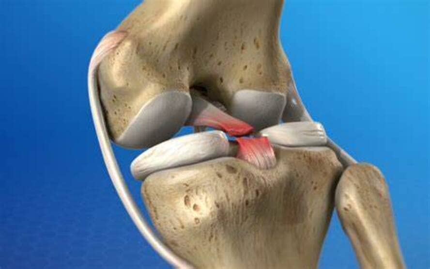 ligamento cruzado anterior