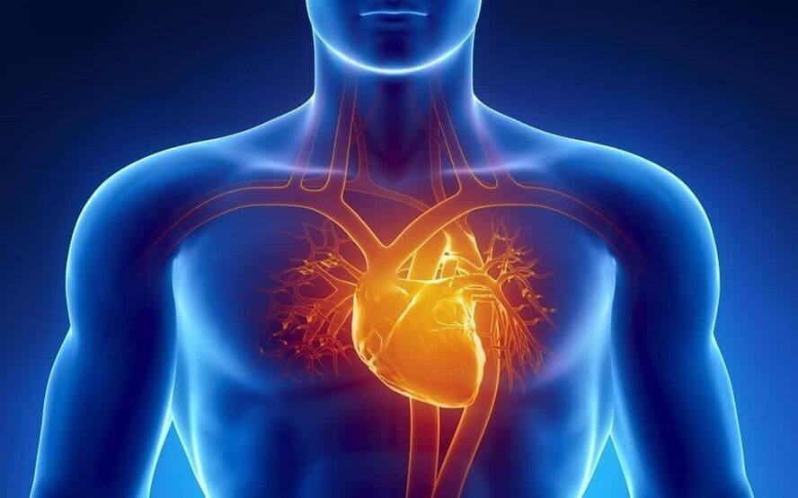 Cardiomiopatia ventricular direita arritmogenica