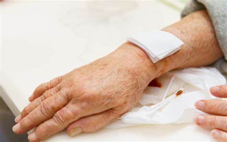 Problemas de pele na artrite reumatoide