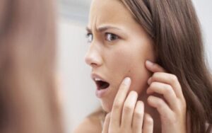 Tocar no rosto pode causar acne