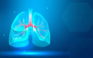 doenca pulmonar obstrutiva cronica