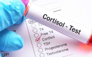 Como funciona um teste de cortisol