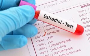 O que e um teste de estradiol e por que e usado