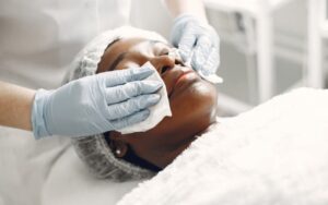 Causas e tratamento da acne cosmetica