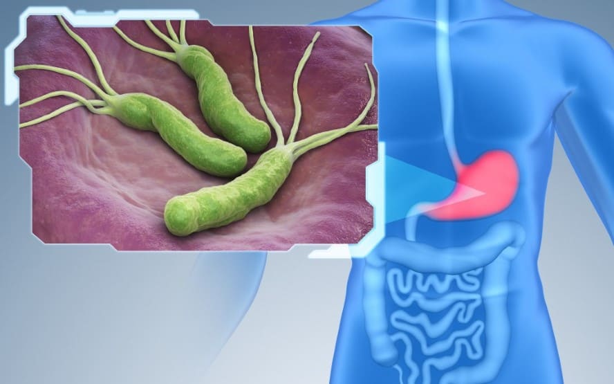 O que e H. pylori