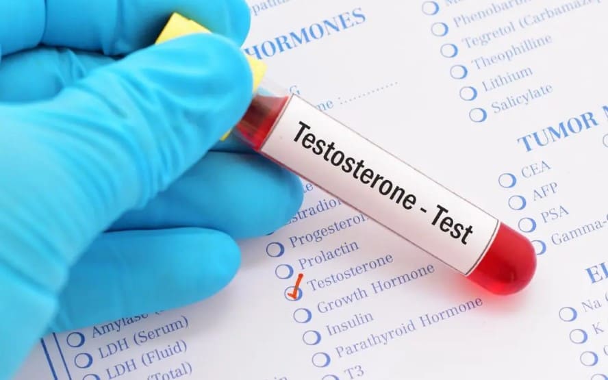 O que saber sobre o teste de testosterona