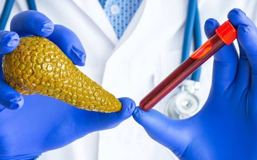 O que saber sobre testes de lipase e pancreas