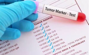 O que sao marcadores de tumor com cancer