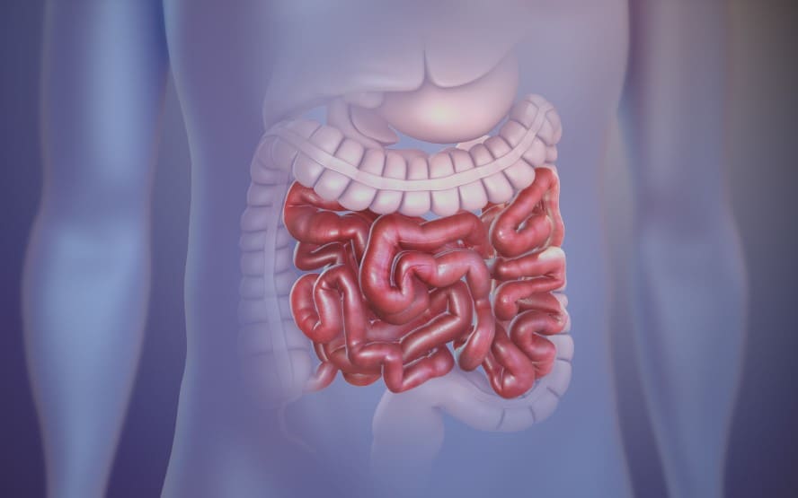 Tratamento da obstrução intestinal devido ao câncer