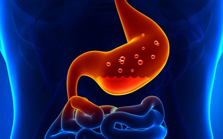 Como voce pode parar o refluxo acido