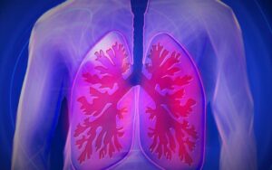 Doenca pulmonar obstrutiva