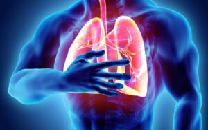 Doenca pulmonar obstrutiva cronica