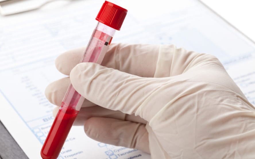 O que e o teste de sangue do antigeno