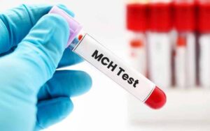 O que significa MCH em um exame de sangue