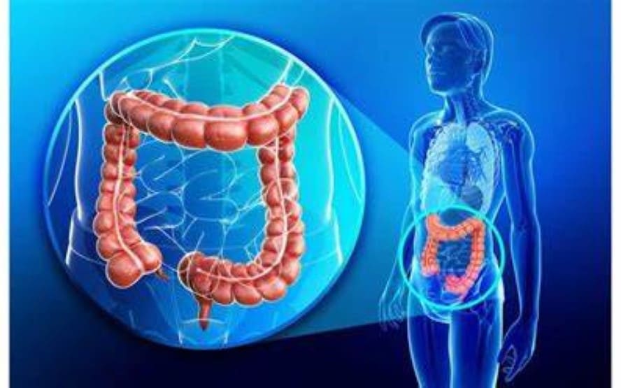 Recuperacao apos cirurgia intestinal explicada 