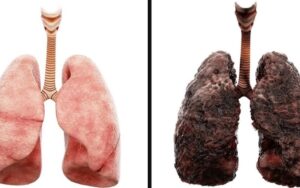 diferencas entre os pulmoes de um fumante e os pulmoes saudaveis