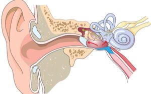 Como tratar e prevenir o barotrauma da orelha 