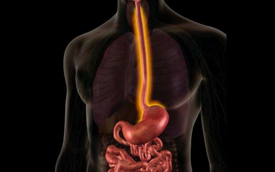 ligacao entre anemia e sindrome do intestino irritavel