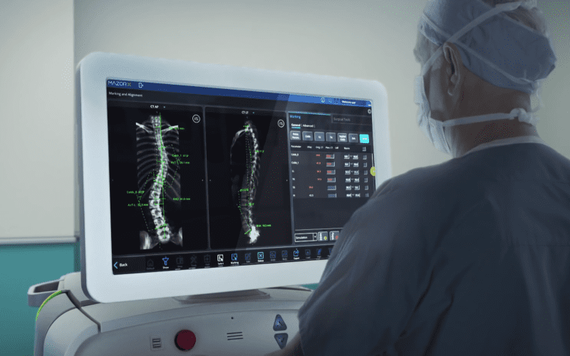 O que e angiograma e angioplastia