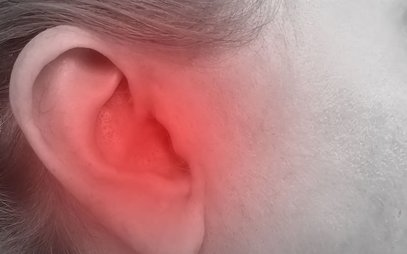 Um guia para a sindrome do ouvido musical