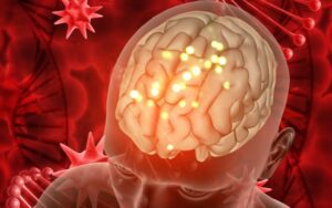 Mitos medicos sobre acidente vascular cerebral