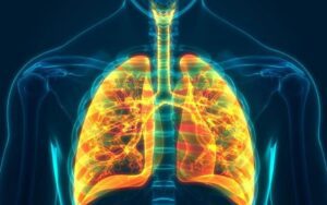 O que e inflamacao dos pulmoes