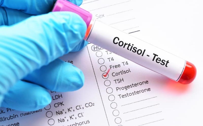 O que e cortisol e por que voce deve testar o seu