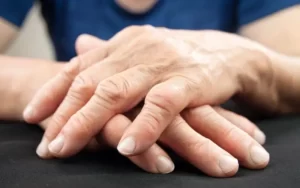 Como encontrar apoio para pessoas com artrite reumatoide