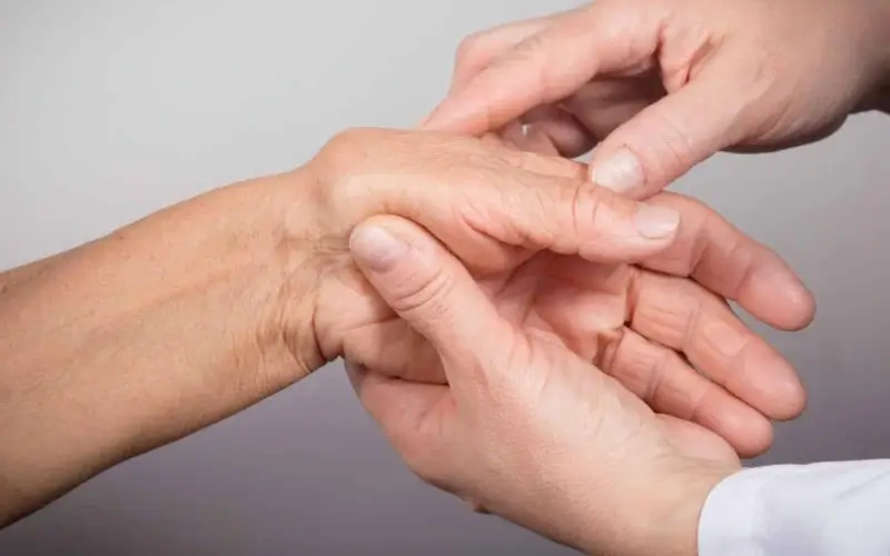 Como tratar artrite reumatoide de forma eficaz