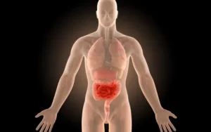 Como manter a doença de Crohn sob controle