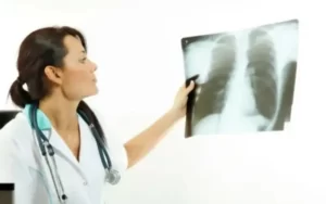 Quais São os Sintomas e Tratamento da Embolia Pulmonar