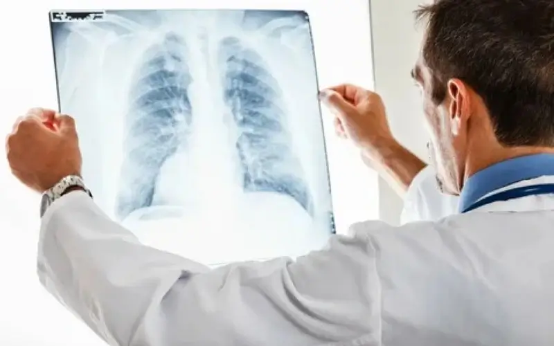 Quais são os principais problemas pulmonares