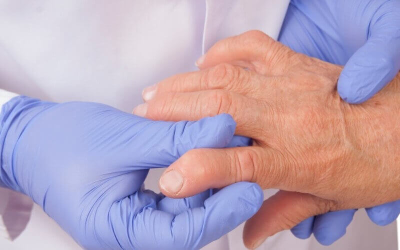Como é feito o diagnóstico da artrite reumatoide