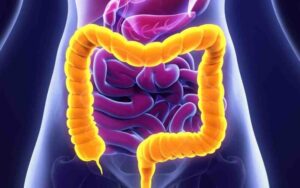 Doença de Crohn e hereditariedade qual a ligação