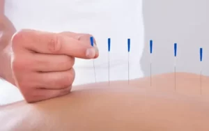 A acupuntura pode salvar seu coração