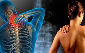 O que causa dores nas costas