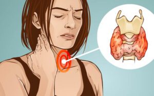 Quais são os sintomas de um problema na tireoide