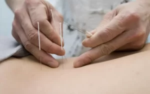 A acupuntura ajuda em problemas renais