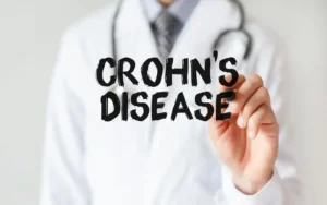 A doença de Crohn pode causar deficiências nutricionais