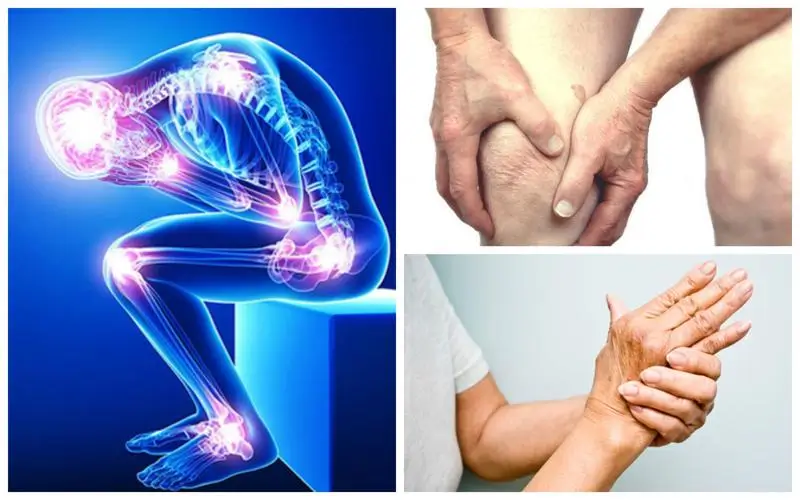Como posso lidar com a fadiga e a dor da artrite no dia a dia