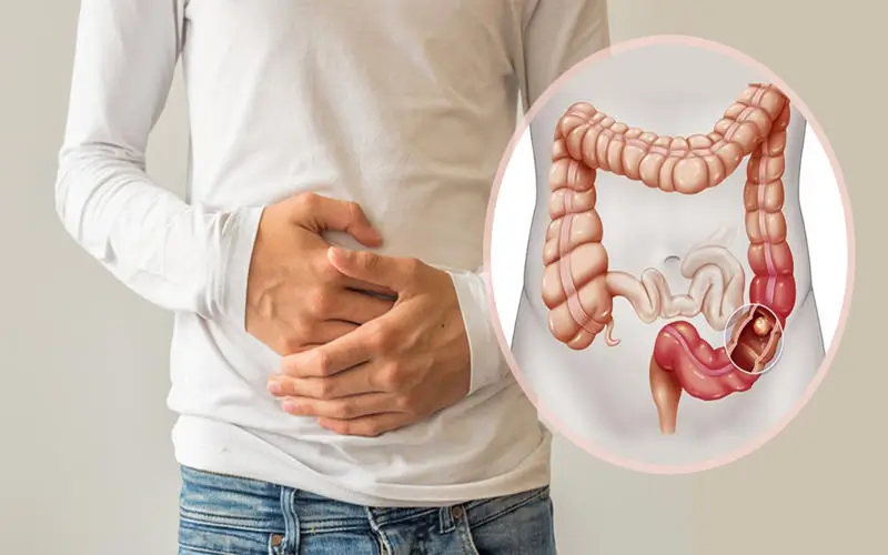 Quais são as causas de problemas digestivos