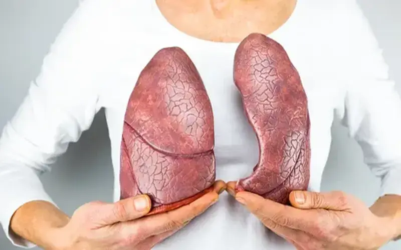 O que é câncer de pulmão