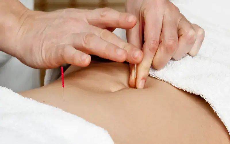 A acupuntura pode ajudar com a Doença de Crohn